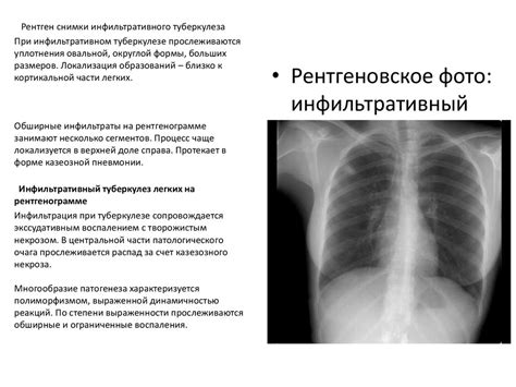 Альтернативы для сохранения одежды при проведении рентгена легких