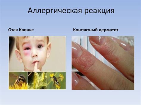 Введение: Факторы, вызывающие аллергические реакции на коже