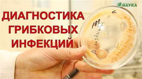 Взаимодействие грибковых инфекций с организмами простейших в микромире