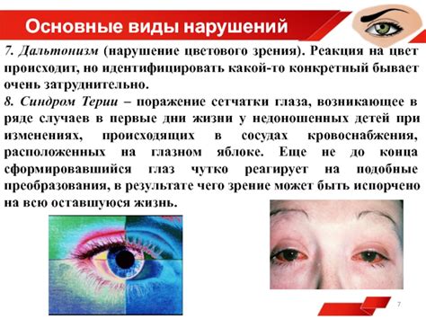 Виды цветового зрения