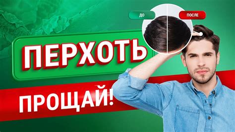 Возможные варианты использования других средств для борьбы с проблемой перхоти на коже головы