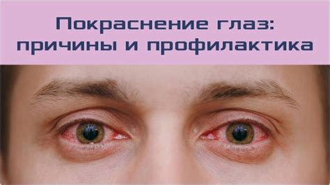 Возможные факторы порождающие покраснение глаз