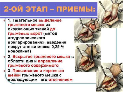 Второй этап: разделение септума от окружающих тканей