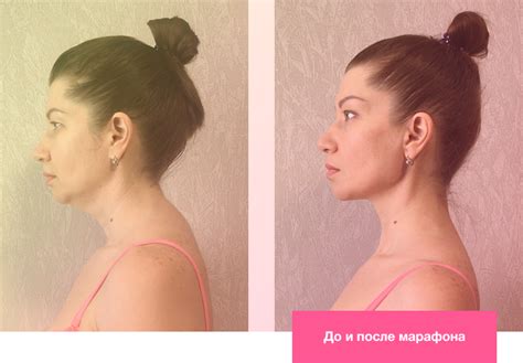 Значимость тренировки области шеи для устранения символического кольца на шее