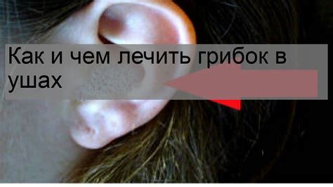 Инфекция в ухе