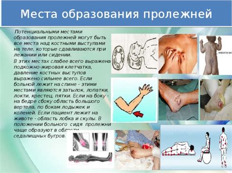 Медицинские последствия ударов в область лобка