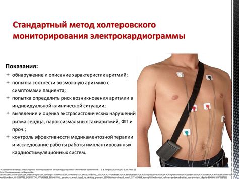 Методы лечения низкого сердечного ритма