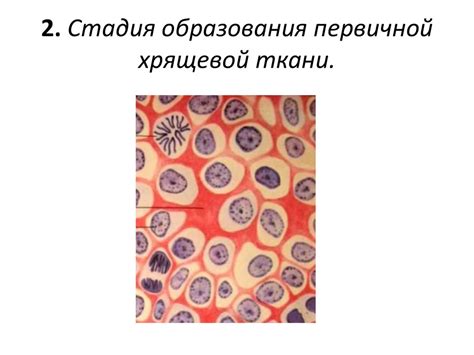 Методы лечения образования на проколе хрящевой ткани