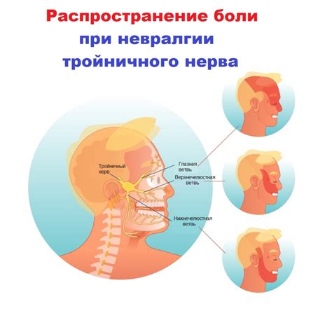 Методы лечения патологий лицевого тройничного нерва и их эффективность