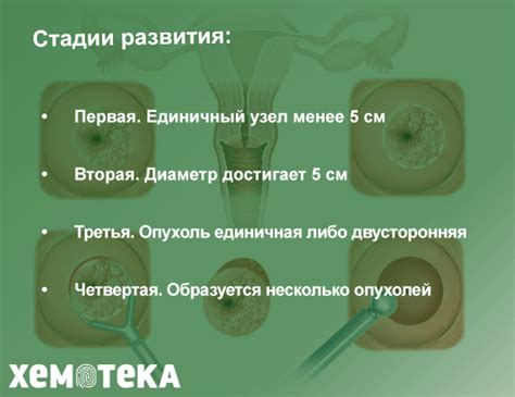 Нейробластома: определение и характеристики