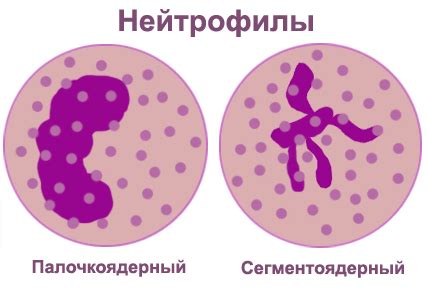 Нейтрофилы: норма и аномалии