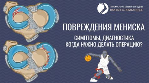 Ограничения и противопоказания к массажу при повреждении мениска