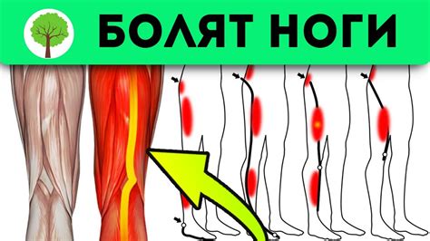 Основные симптомы невропатических болей в ногах