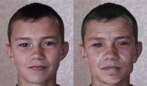 Основные факторы, вызывающие отечность в области лица после употребления алкоголя