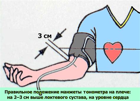 Основы замера давления на атоничной кисти руки