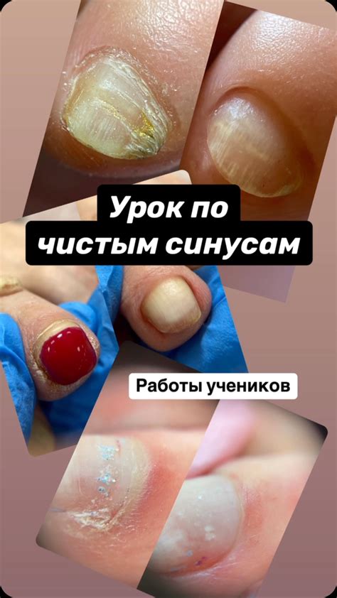Оформите форму ногтей: позаботьтесь о кутикуле и удачно удалите ороговевший слой