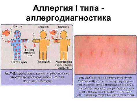 Повышенная вероятность аллергических реакций у отдельных ребенков
