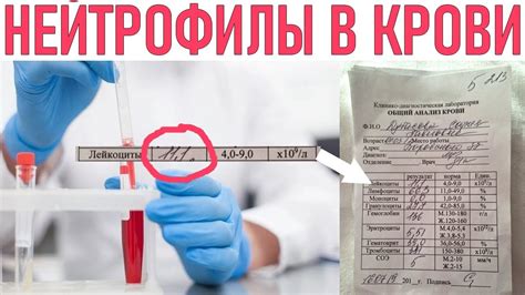 Повышенный уровень нейтрофилов после хирургических операций: причины и последствия