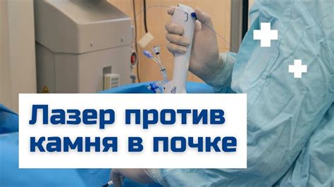 Подводные камни при удалении ICCP профиля и способы их избежать