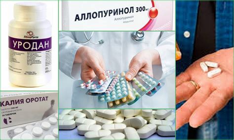 Полезные советы для тех, кто страдает от избытка мочевой кислоты и хочет попробовать голодание