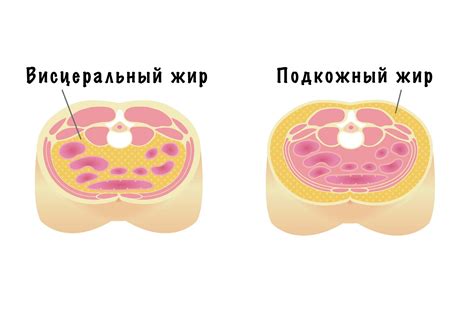 Понимание особенностей висцерального и подкожного жира