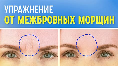Популярные способы устранения излишков кожи на руках без хирургического вмешательства