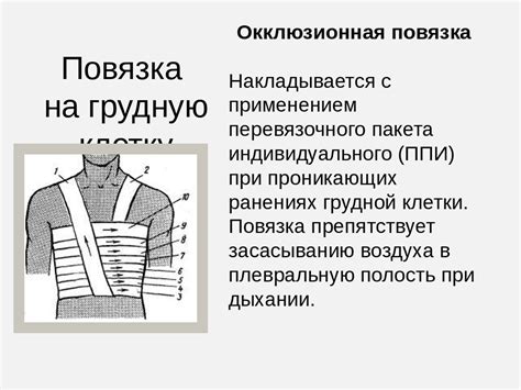 Последовательность надевания окклюзионной повязки на конечность
