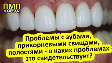 Предотвращает проблемы с зубами