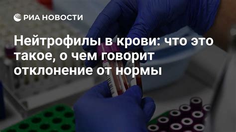 Причины пониженных нейтрофилов и повышенных лимфоцитов у женщин