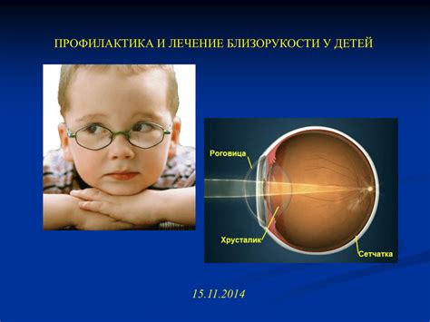 Причины развития близорукости