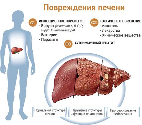Причины развития низкодифференцированной аденокарциномы печени