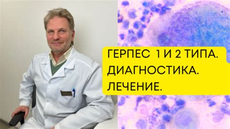 Распознавание типа лиша и правильная диагностика