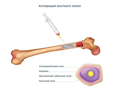 Рациональный подход к безопасному приему пищи перед процедурой извлечения костного мозга