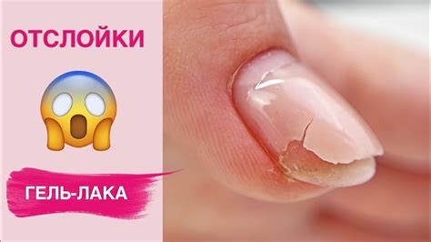 Секреты продления срока носки геля на поврежденных ногтях