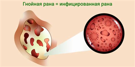 Симптомы и последствия инфекции