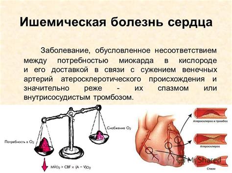 Синдром "призрачного кровотока" и его объяснение
