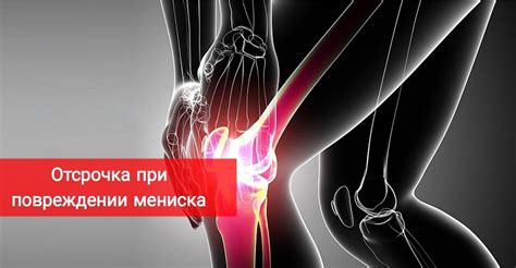 Ситуации, при которых следует воздержаться от проведения массажа при повреждении мениска