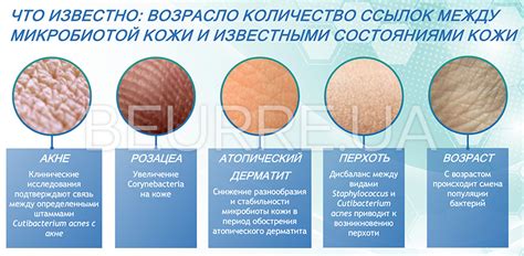 Состояние кожи в норме