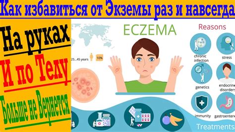 Умывание для борьбы с бактериями: эффективный способ очистить кожу