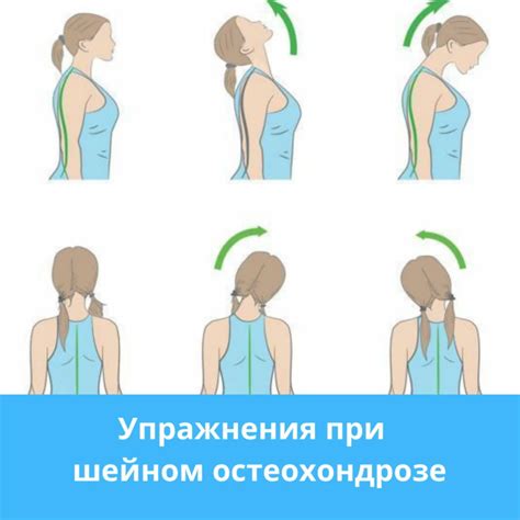 Упражнения на растяжение и укрепление мышц шеи