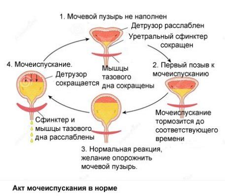 Факторы, влияющие на возникновение частого позыва к мочеиспусканию