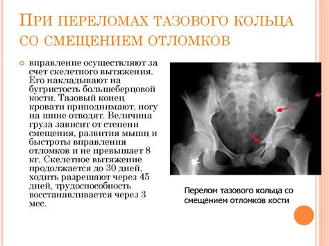 Физиология повреждения позвоночника