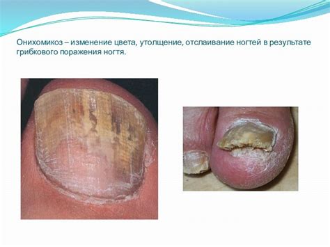 Химический состав праймера и его влияние на отслаивание ногтей