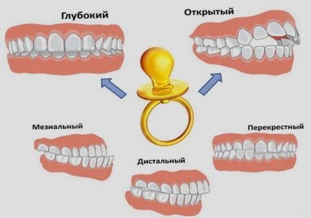 Цель остеопатии в лечении проблем со прикусом у ребенка