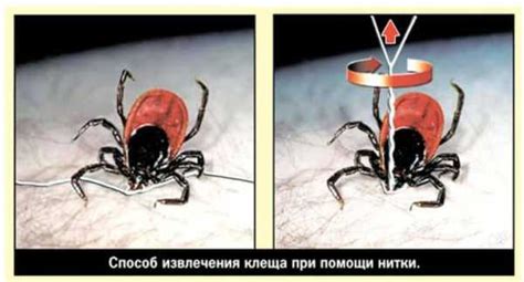 Что делать, если обнаружен клещ на теле: превентивные действия и дальнейшие шаги