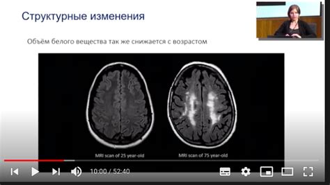 Что происходит с головой при проколе индастриал