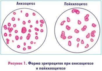 Что такое низкий показатель эритроцитов