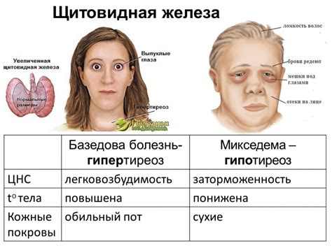 Щитовидная железа и гормональные нарушения