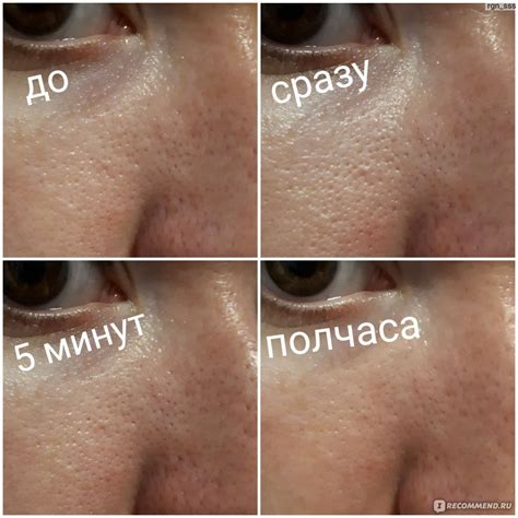 Эффективное сужение пор с помощью использования тонеров