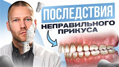  Вредные последствия неправильного процесса промывания 